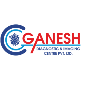 Digital Chest X-Ray Test Price By Ganesh Diagnostic