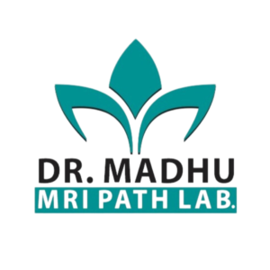 Digital Chest X-Ray Test Price By Dr Madhu Path Lab